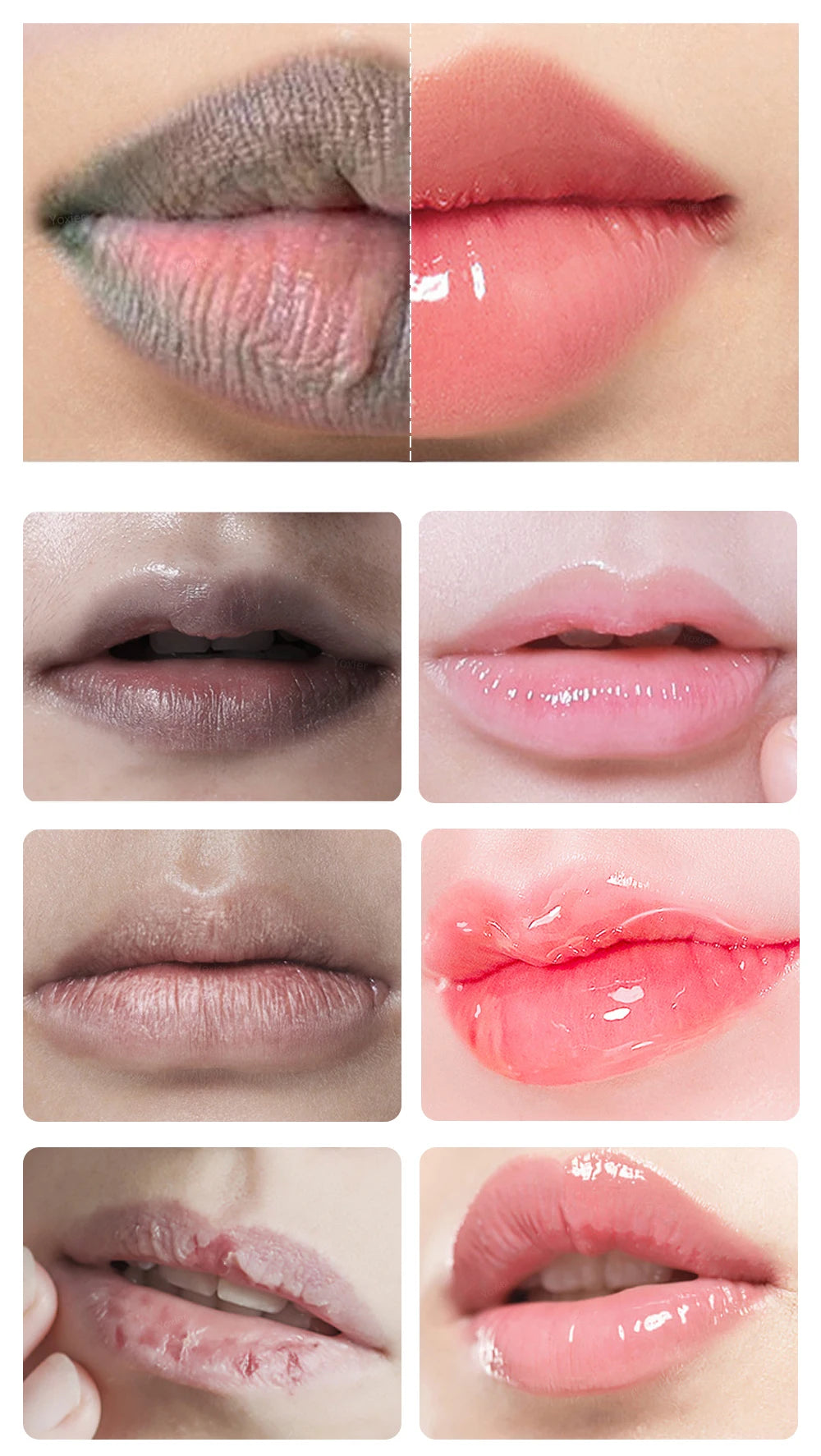 Lip Lightening Scrub Balm Lighten Pigmentation Remove Lip Lines Dead Skin Stains Moisturizing Nourish Brighten Black Lips 20g